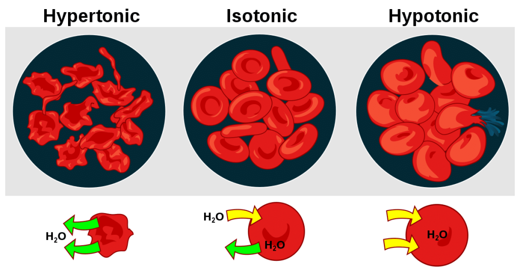 What Is A Hypotonic Definition And Hypotonic Solution? Best Examples