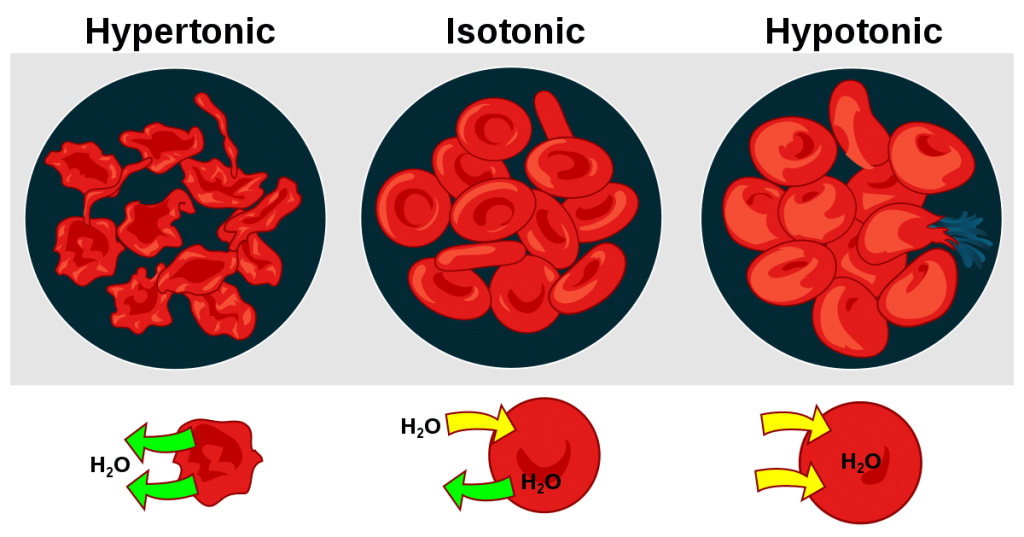 What Is A Hypotonic Definition And Hypotonic Solution? Best Examples ...